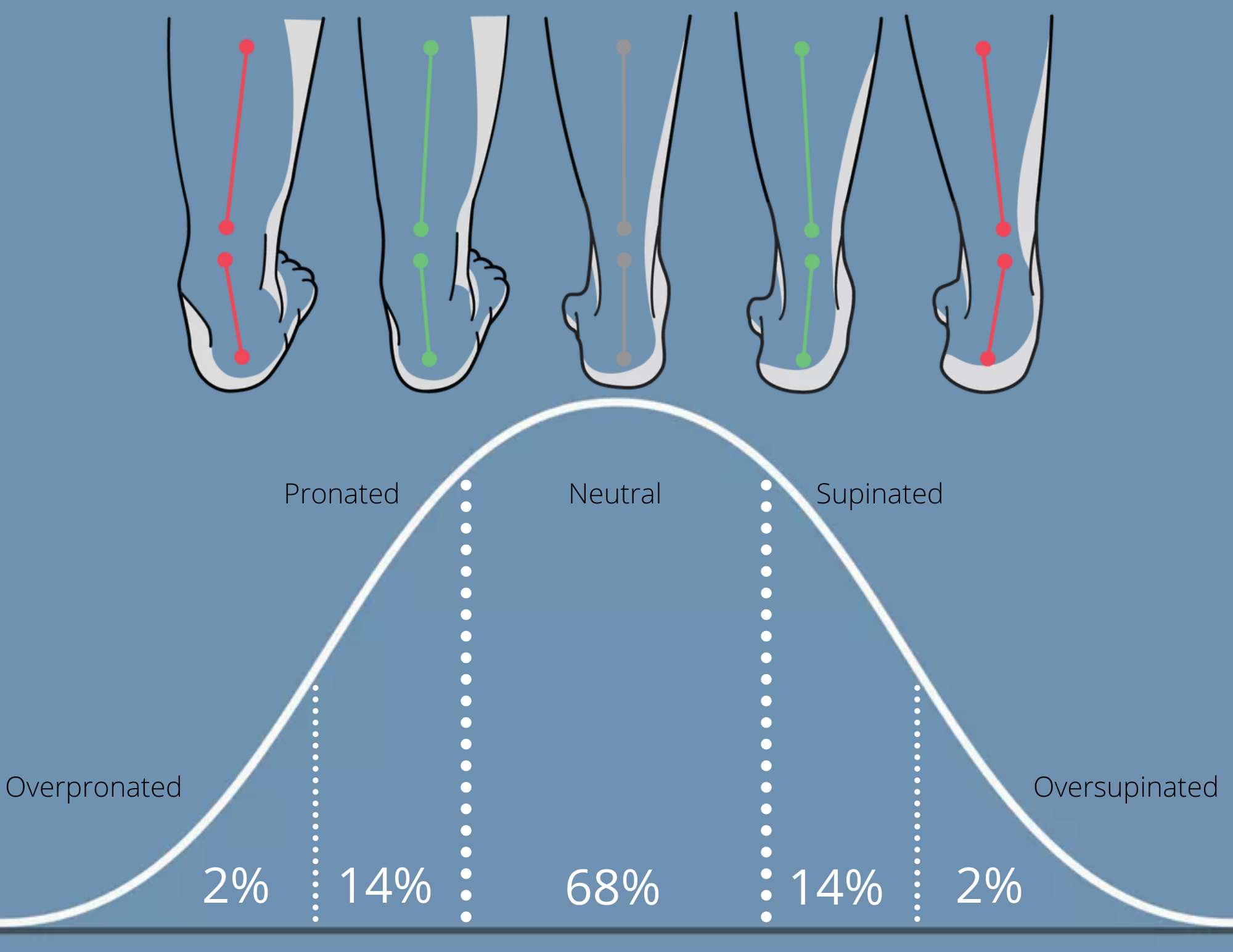 Foot Posture Bell Curve