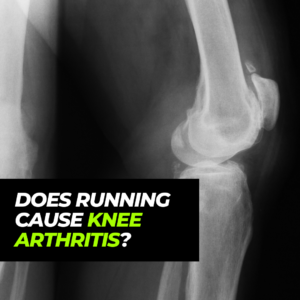 Does running cause knee arthritis podcast