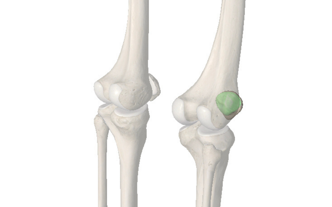 Patellofemoral Joint Runners Knee