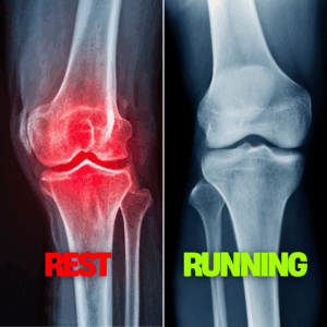 Rest from Running Makes Knee Arthritis Worse